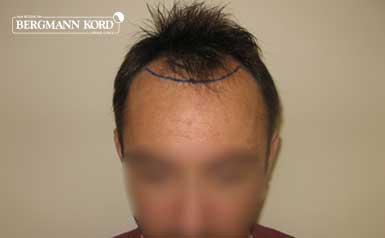 metamosxefsi-malliwn-apotelesmata-andres-41035PG-index