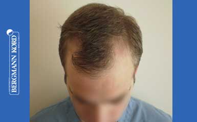 metamosxefsi-malliwn-apotelesmata-andres-43014PG-index