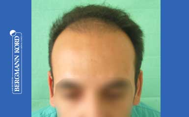 metamosxefsi-malliwn-apotelesmata-andres-44039PG-index