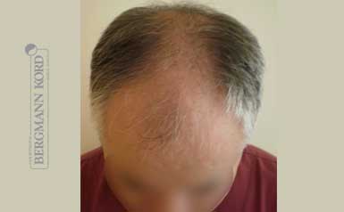 metamosxefsi-malliwn-apotelesmata-andres-49028PG-index