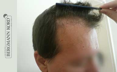 metamosxefsi-malliwn-apotelesmata-andres-53004PG-index