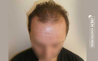 metamosxefsi-malliwn-apotelesmata-andres-53012PG-index