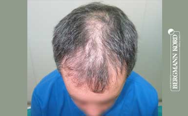 metamosxefsi-malliwn-apotelesmata-andres-55015PG-index