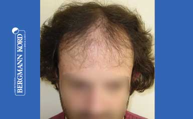 metamosxefsi-malliwn-apotelesmata-andres-59033PG-index