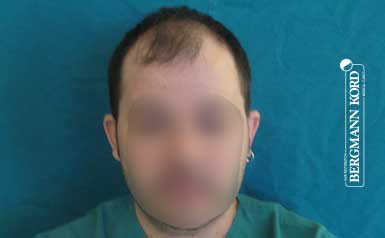 metamosxefsi-malliwn-apotelesmata-andres-62017PG-index