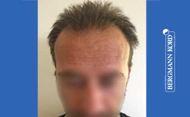 metamosxefsi-malliwn-apotelesmata-andres-62020PG-index