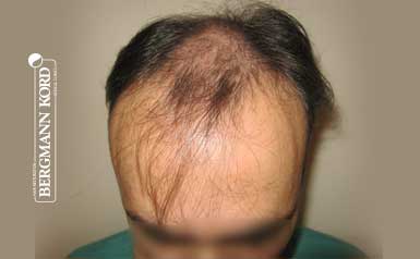 metamosxefsi-malliwn-apotelesmata-andres-66029PG-index