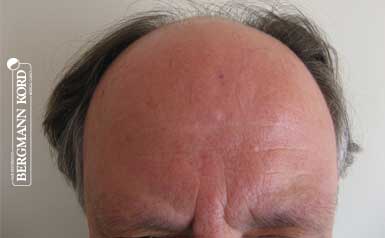 metamosxefsi malliwn apotelesmata andres 49021pg