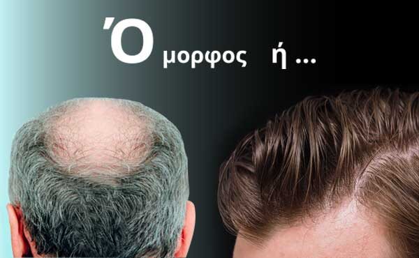 metamosxefsi-malliwn-bergmann-kord-diagnosi-promo-jun-2020-thumbnail-001