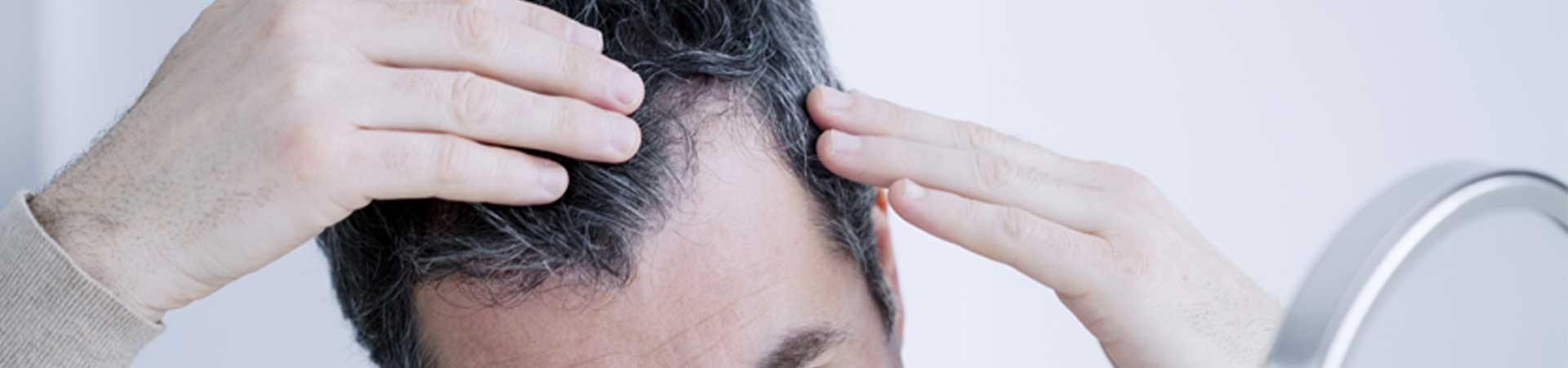 Hair Loss Consultation & Diagnosis