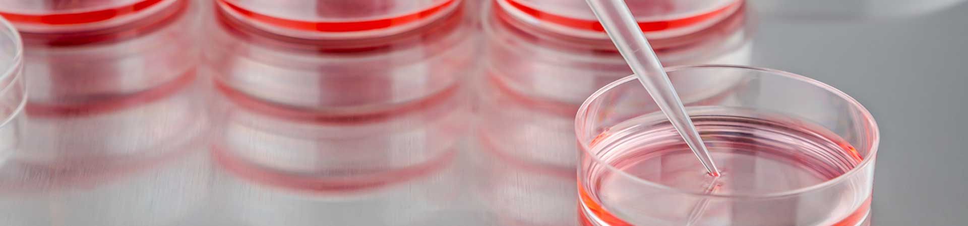 Stem Cells in Hair Transplants – Hair Cloning Research