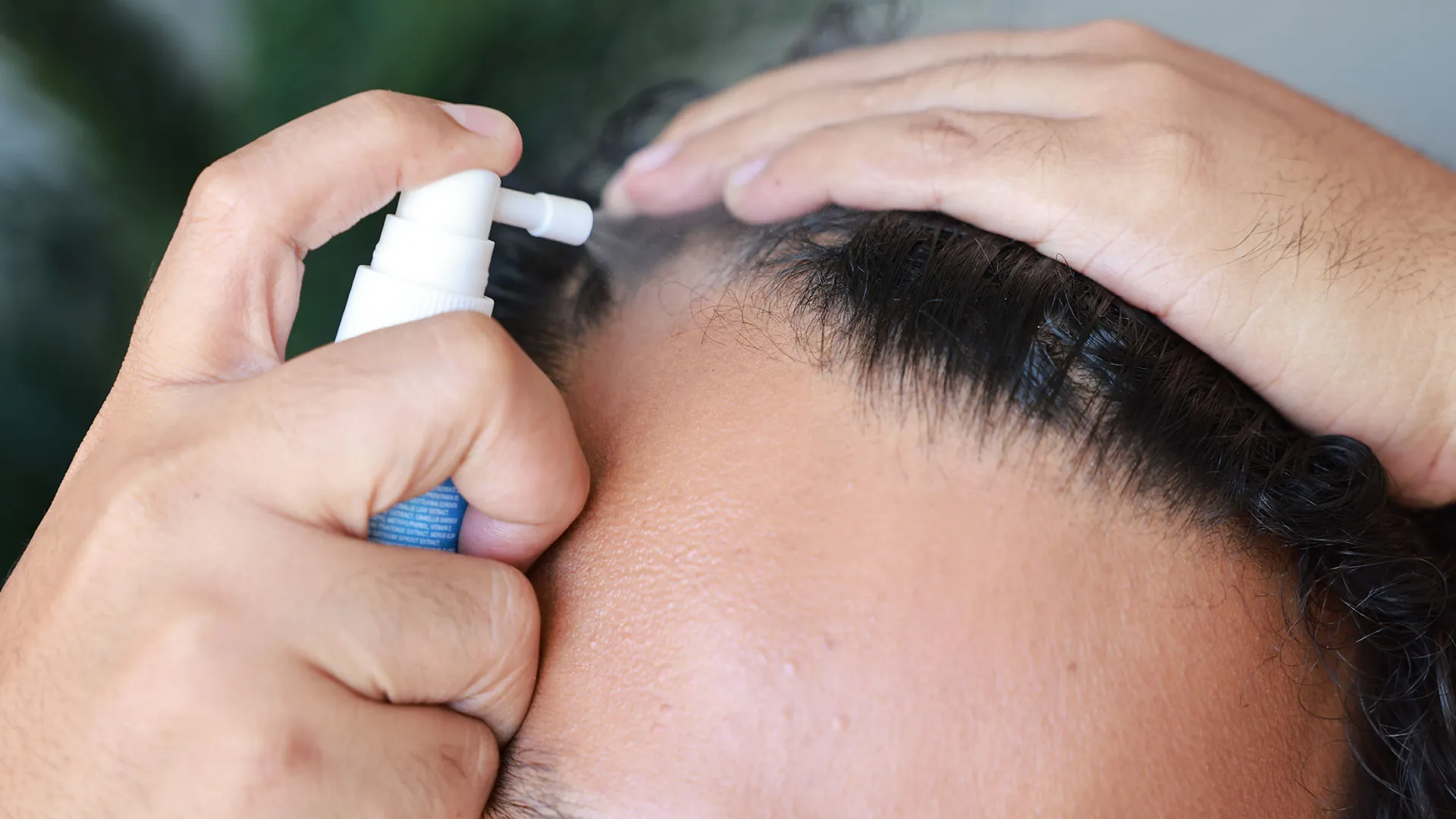 Φαρμακευτικές αγωγές κατά της τριχόπτωσης