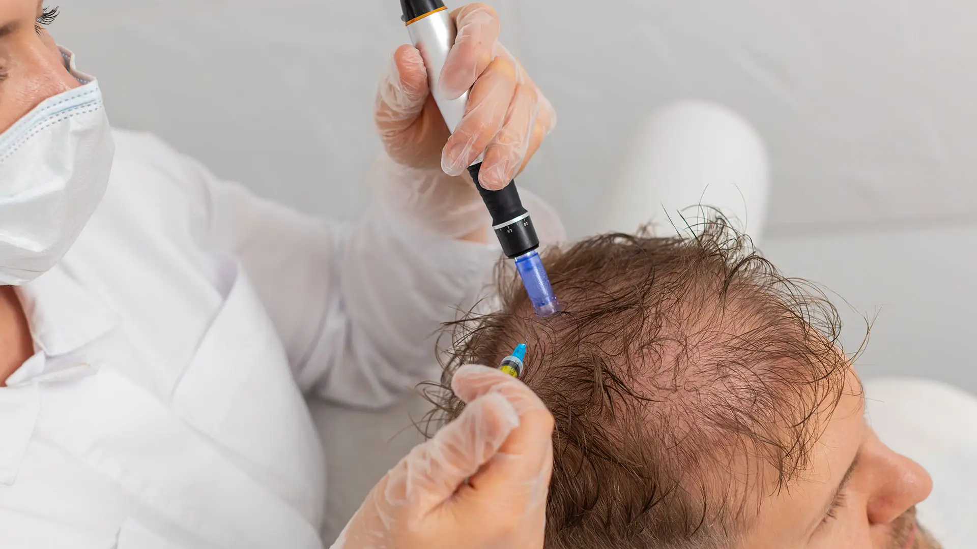Μεσοθεραπεία μαλλιών κατά της τριχόπτωσης για την διείσδυσή θρεπτικών συστατικών στα τριχοθυλάκια και την ενίσχυση της τριχοφυίας.