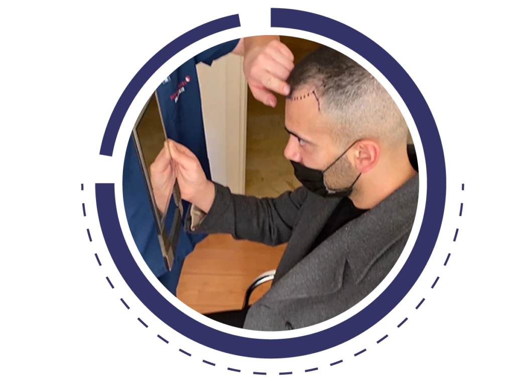 Υποψήφιος για εμφύτευση μαλλιών μαζί με τον γιατρό.