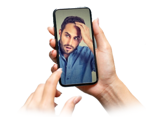 Online διάγνωση μεταμόσχευση μαλλιών