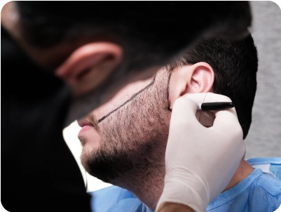 Σχεδιασμός μεταμόσχευσης γενιών από ιατρό