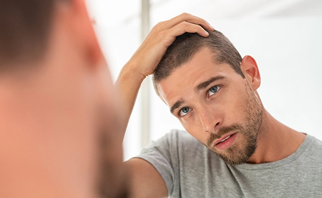 Πρόληψη τριχόπτωσης σε άνδρα που αρχίζει να εμφανίζει τα πρώτα σημάδια αραίωσης στο τριχωτό