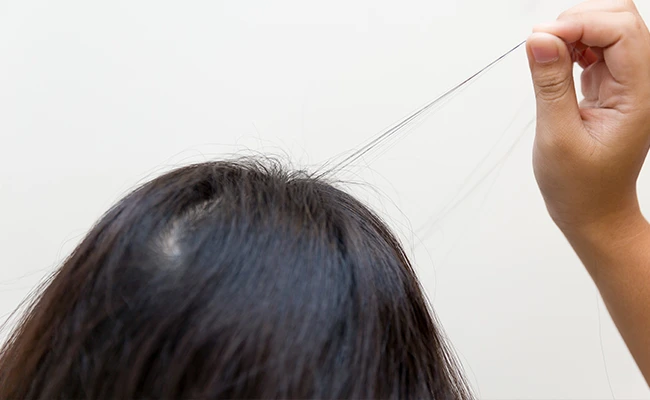 Γυναίκα με τριχοτιλλομανία τραβάει τα μαλλιά της