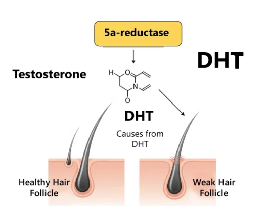 TEstosterone to DHT