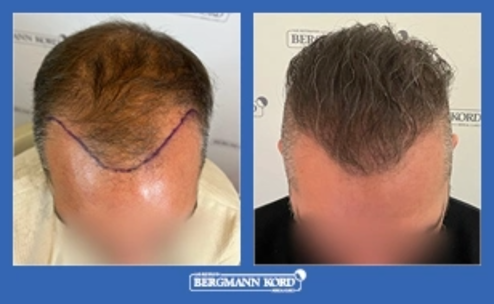 Περιστατικό 20938-PG