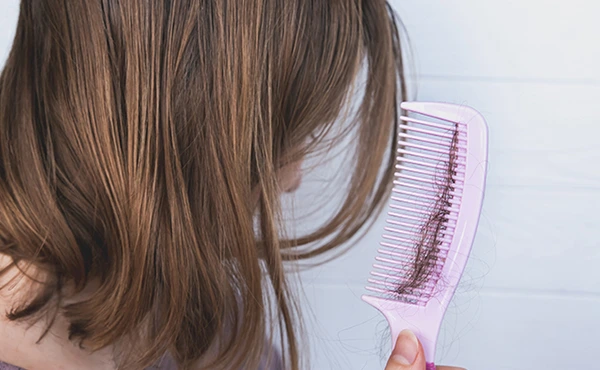 Εποχική τριχόπτωση σε γυναίκα που βλέπει τρίχες στη χτένα