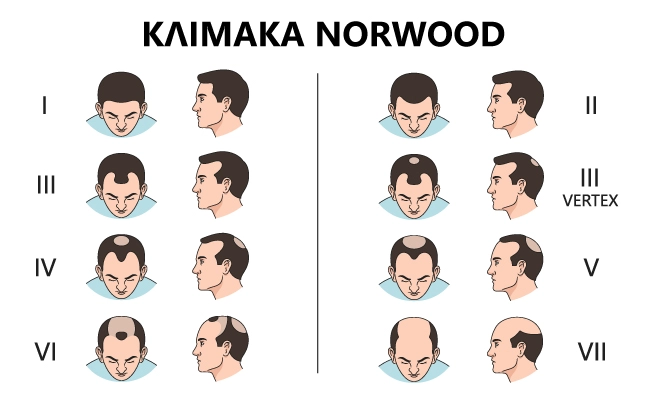 Κλίμακα Noorwood