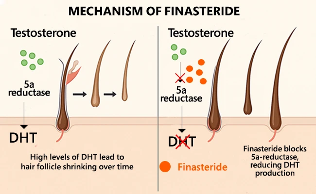 Mechanism of Finasteride