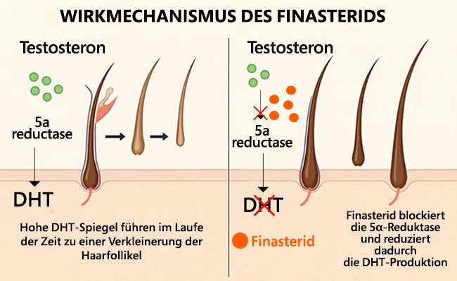 Wirkmechanismus des Finasterids