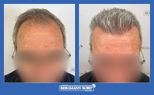 Περιστατικό 43562-PG