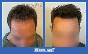 Περιστατικό 50487-PG